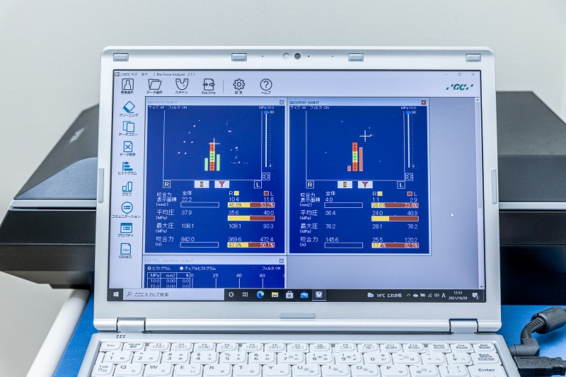 バイトフォースアナライザー